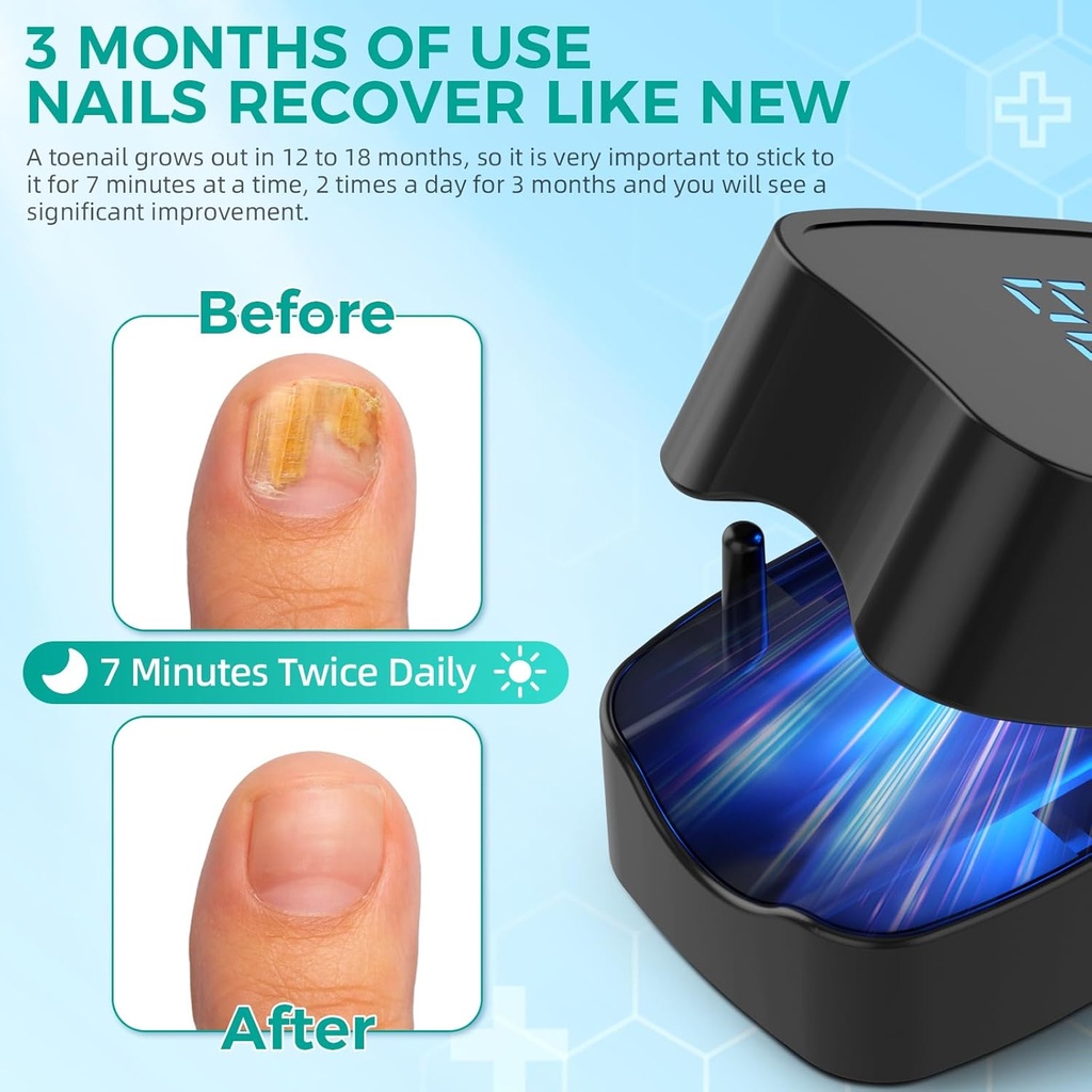 nail-fungus-laser-treatment-led-light-de-5.jpg