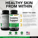 greenford-eczema-treatment-support-for-n-6.jpg
