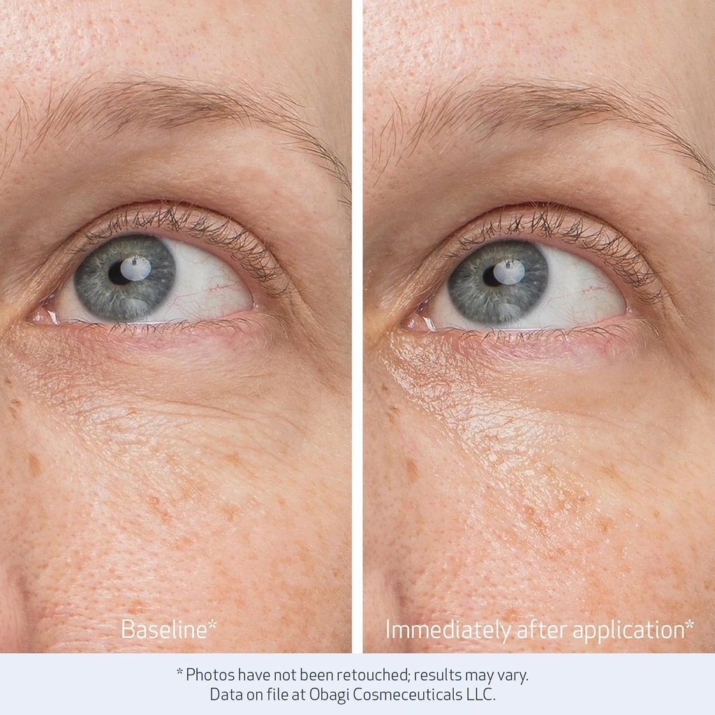 obagi-daily-hydro-drops-rejuvenating-eye-5.jpg