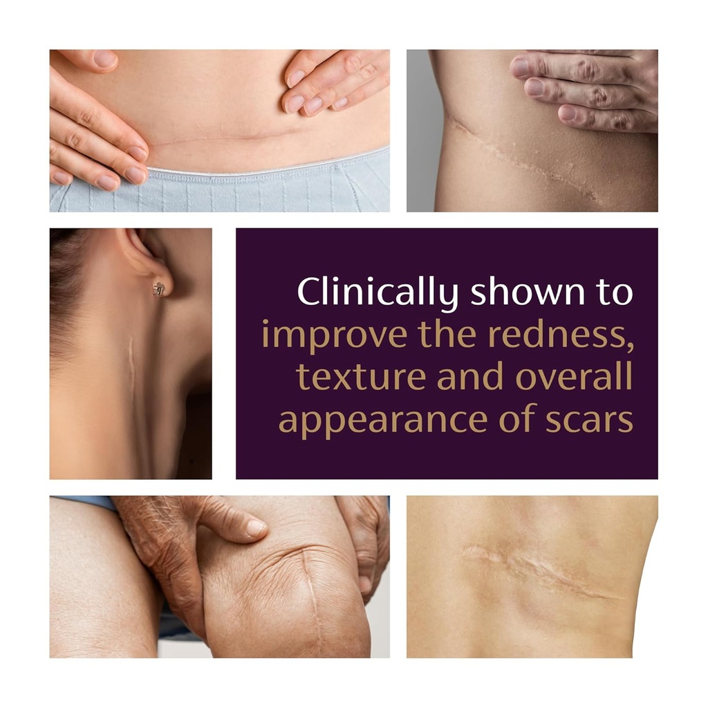 mederma-advanced-scar-gel---treats-old-n-5.jpg
