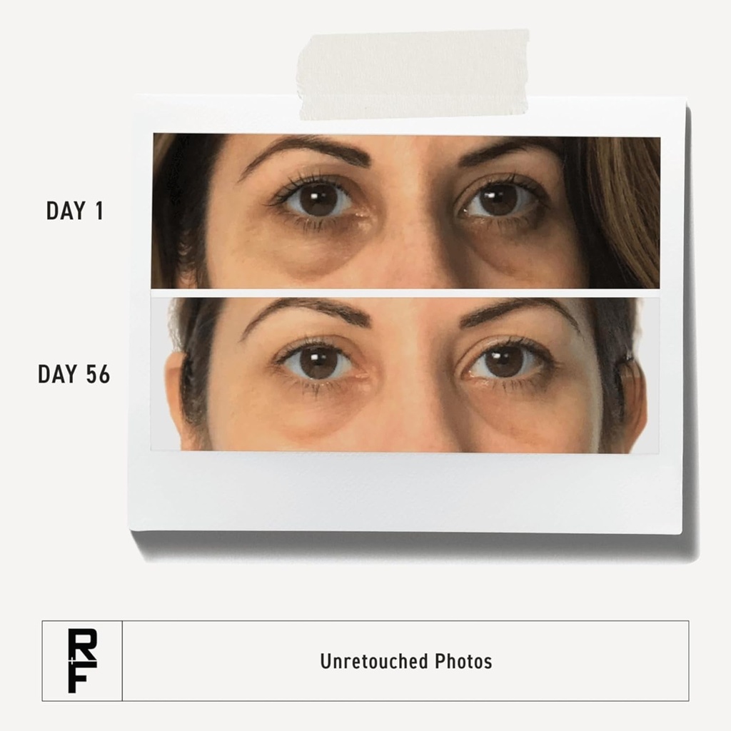 rodan-fields-active-hydration-bright-eye-3.jpg