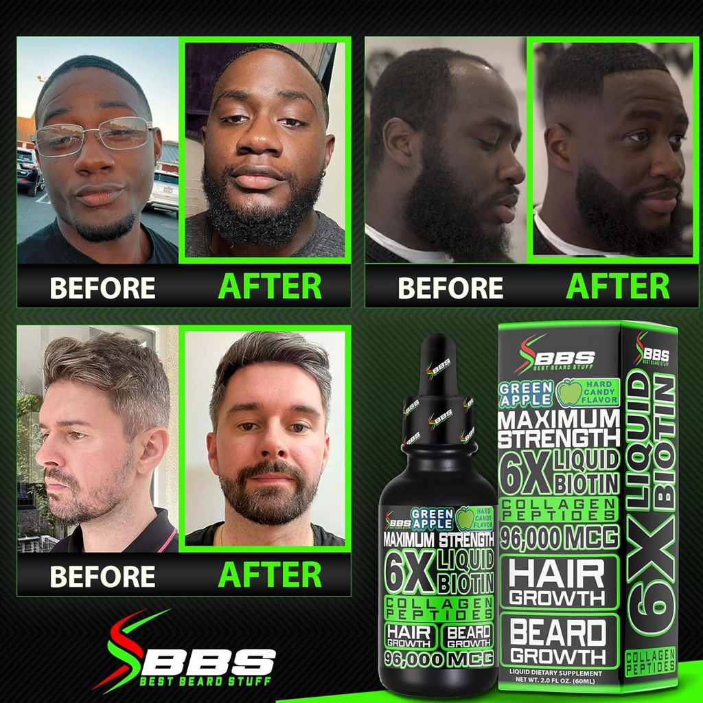 beard-growth-kit-w-6x-liquid-biotin-supp-4.jpg