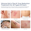 100-silicone-scar-gel-scar-cream---advan-2.jpg