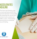 dynarex-3012-curafoam-foam-dressing-non--5.jpg