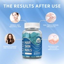 2025-hair-skin-and-nails-vitamins-gummie-2.jpg
