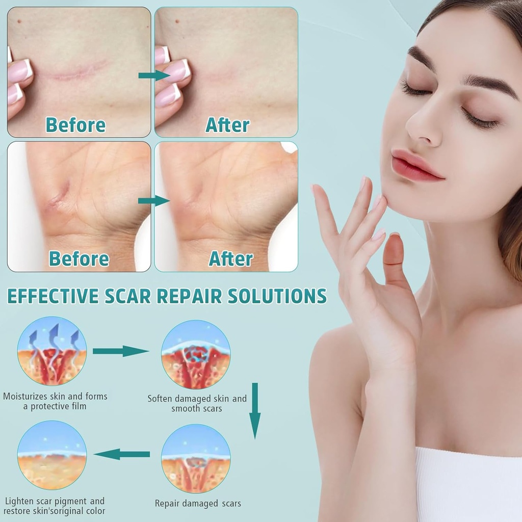advanced-scar-cream-silicone-gel-for-sca-4.jpg