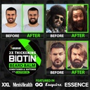 beard-growth-kit-w-2x-thickening-biotin--3.jpg