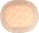 7-x-8-oval-gentle-border-foam-dressing-f-3.jpg