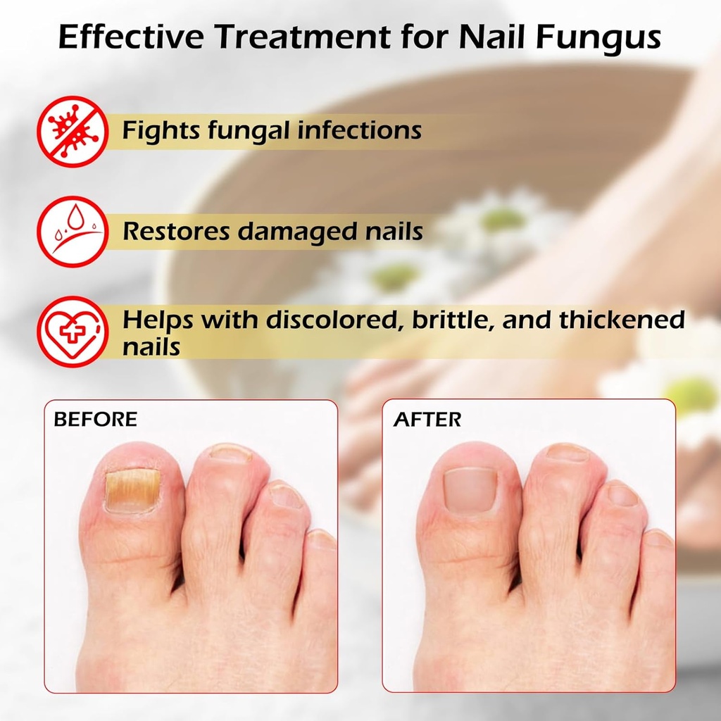 toe-nail-fungus-treatments-for-toenail-n-2.jpg