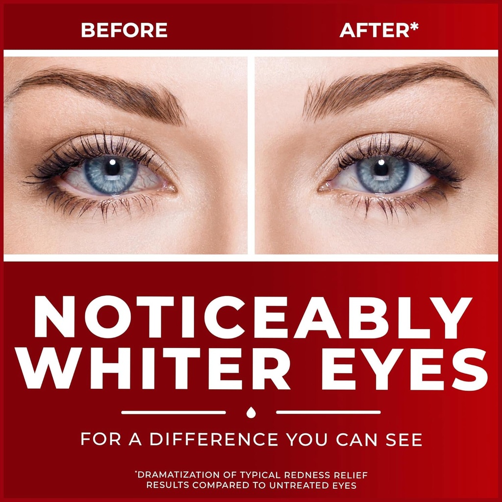 clear-eyes-maximum-redness-eye-relief-ey-4.jpg