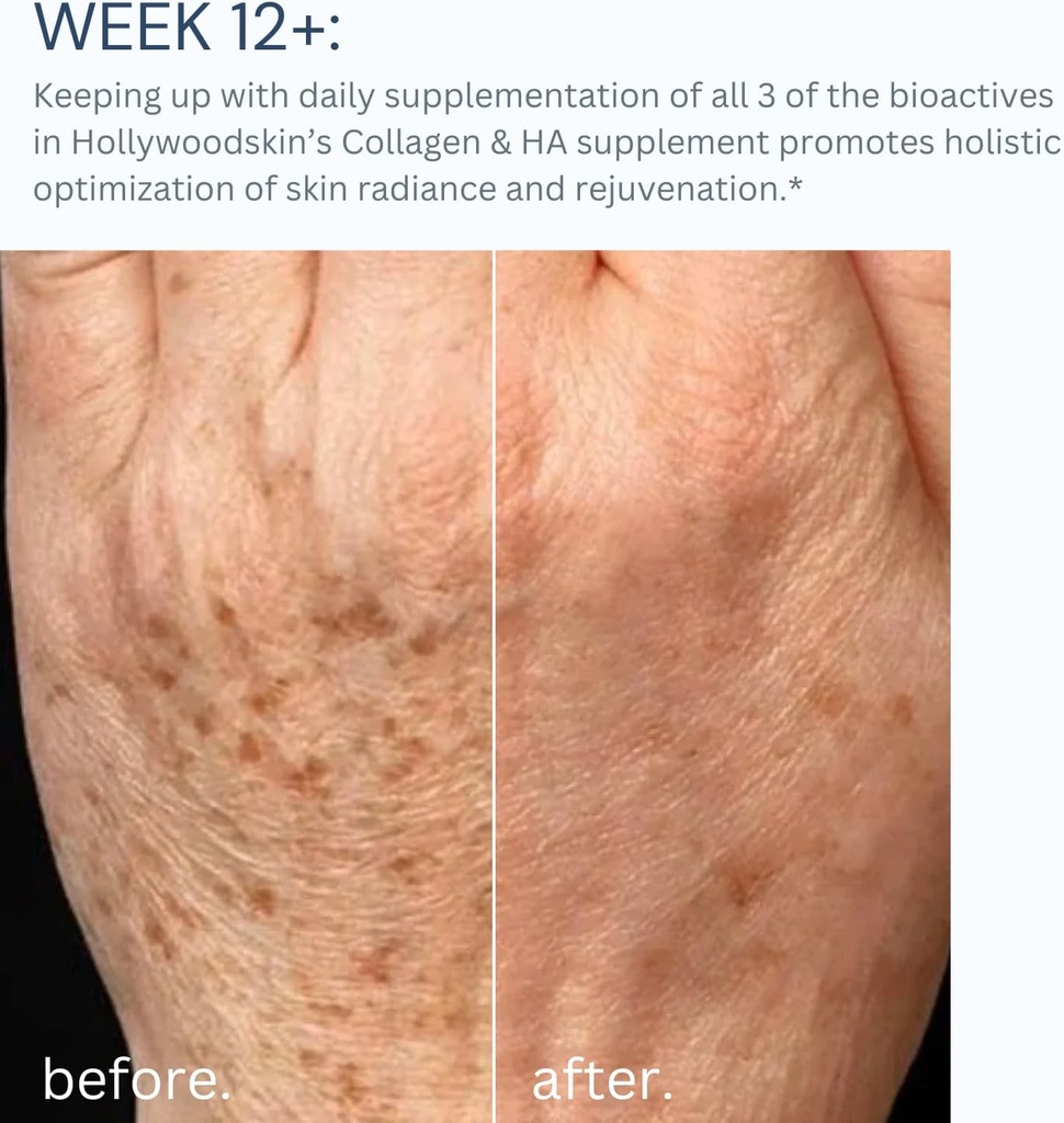 hollywoodskin-peptan-collagen-complex-fo-5.jpg