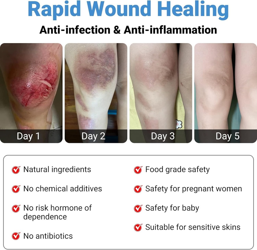 lmnoop-wound-healing-ointment-for-chroni-6.jpg