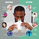 nasal-irrigation-system-with-150-salt-pa-4.jpg