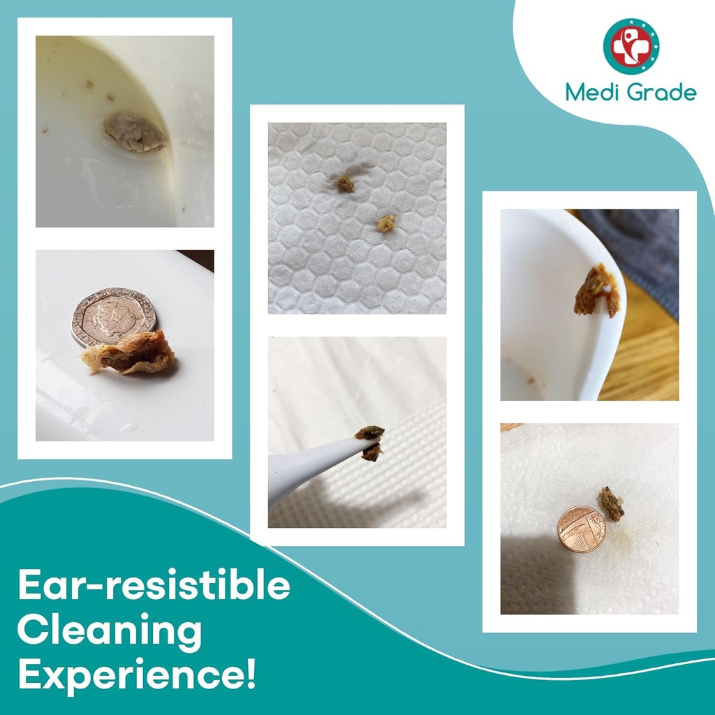 medi-grade-ear-cleaning-kit-including-ea-2.jpg