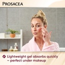 prosacea---medicated-rosacea-treatment-f-5.jpg