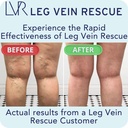 diosmin-leg-circulation-supplement-clini-3.jpg