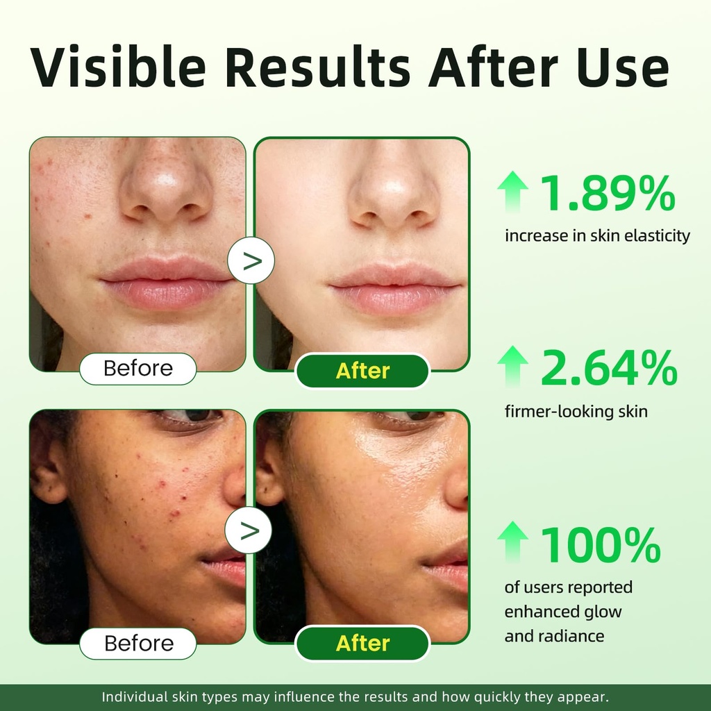 vitamin-c-serum-for-face-20-brightening--5.jpg