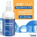 skinsmart-antimicrobial-eczema-therapy-w-4.jpg
