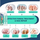 nail-fungus-treatment-pen-with-tea-tree--4.jpg