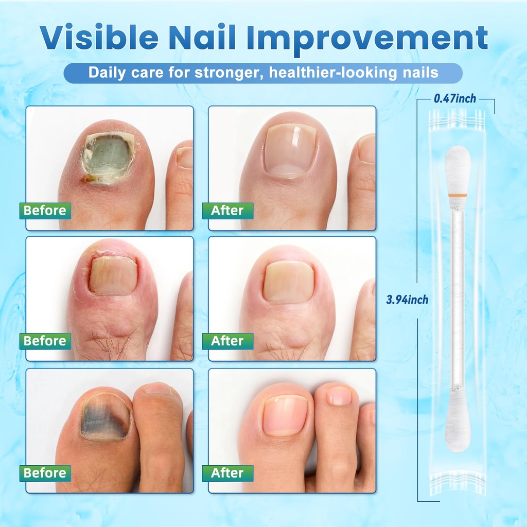 fungal-nail-treatment-swabs-100-ct-extra-3.jpg