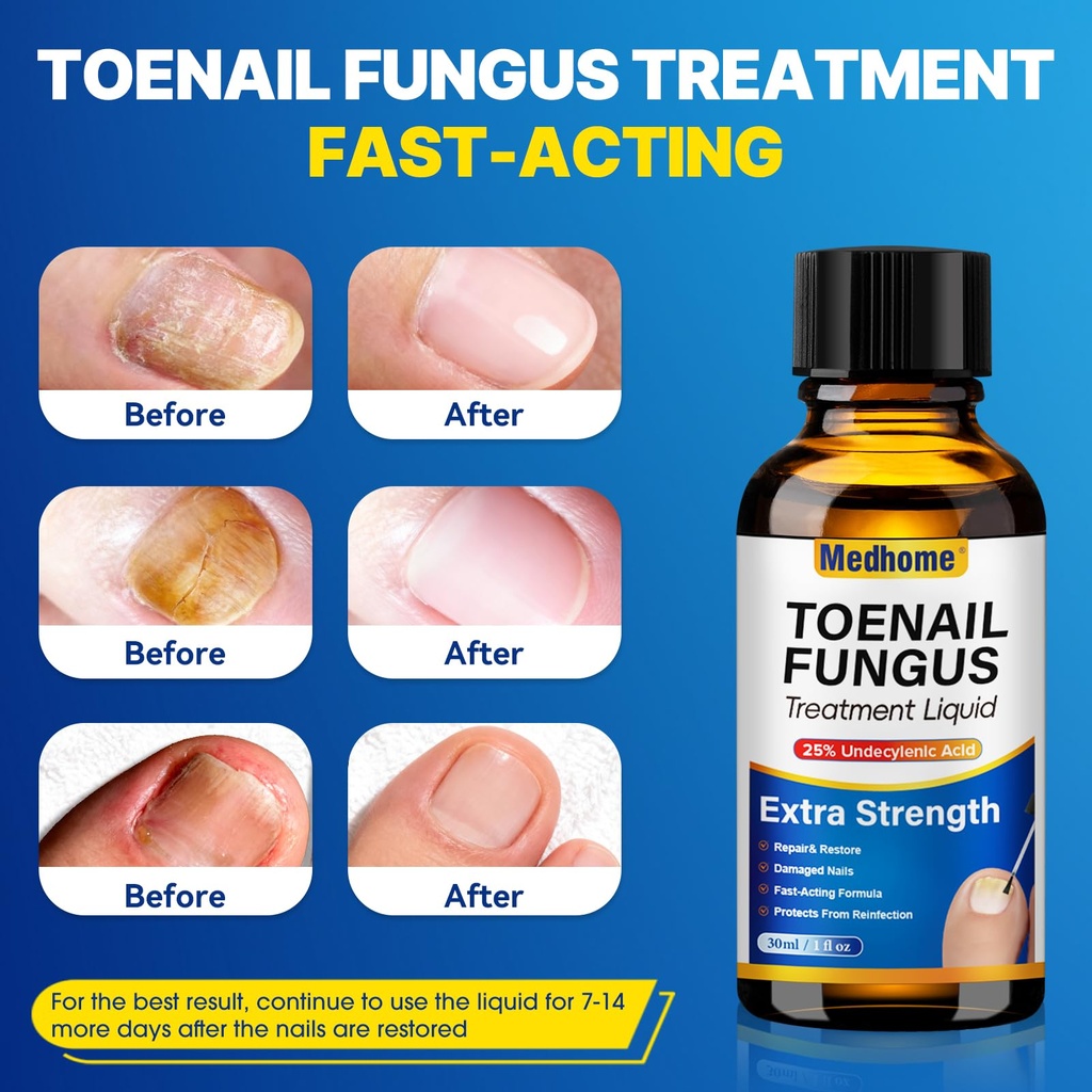 toenail-fungus-treatment-extra-strength--3.jpg