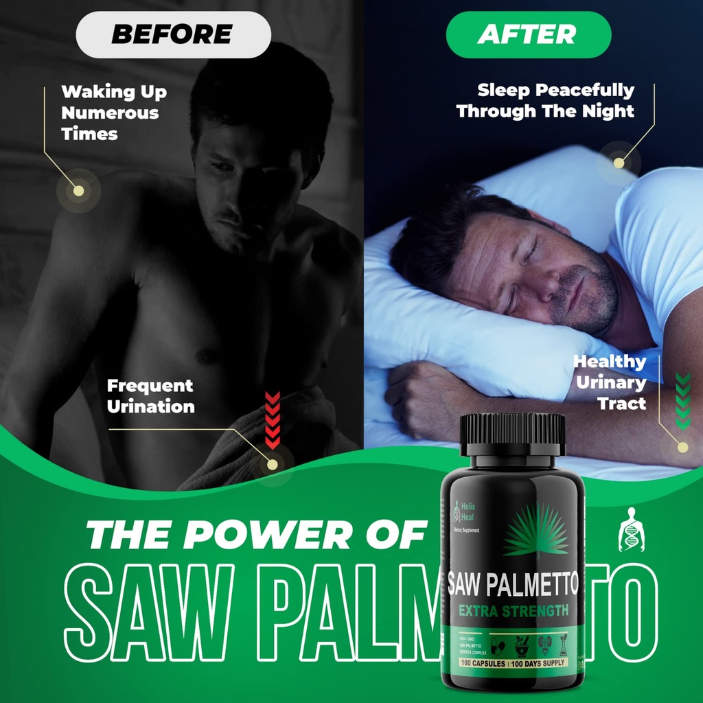 saw-palmetto-for-men-prostate-health-sup-4.jpg
