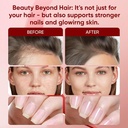biotin-hair-growth-gummies-for-women-100-5.jpg