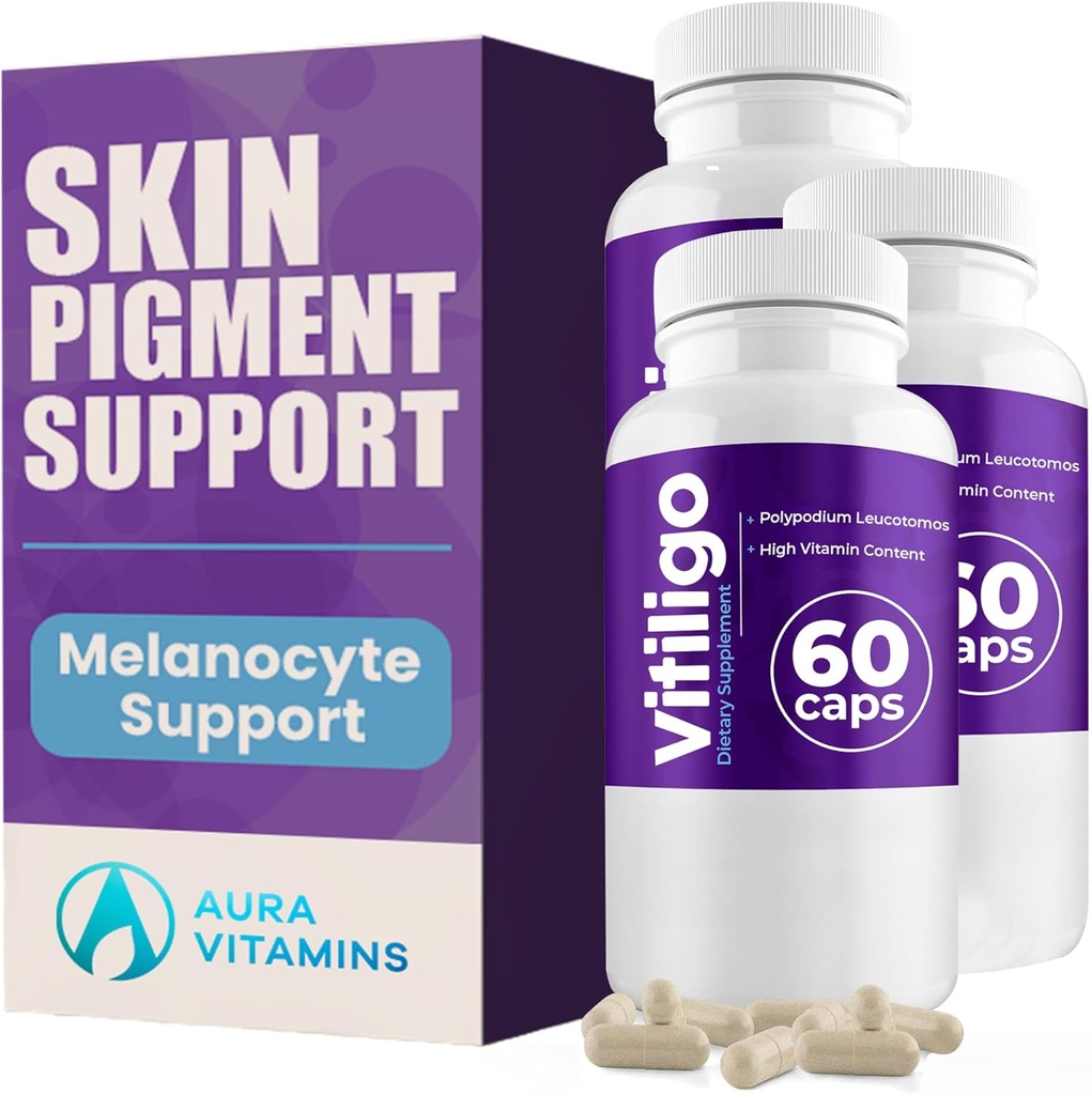 Vitiligo Capsules 60 Compte de 1 mois Améliorer le soutien de la pigmentation de la peau et réduire les taches blanches.