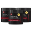 iRestore Advanced Hair Growth Supplement pour les femmes, Vitamines capillaires pour une croissance plus rapide des cheveux, le meilleur pour la perte de cheveux et la minceur - 1 mois d'approvisionnement Chacun - 30 Compte (paquet de 3) - Noir