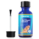 Traitement des champignons des ongles - Traitement des champignons des ongles pour les ongles - Traitement des champignons des ongles - Traitement des ongles - Traitement des champignons des ongles (30ml)