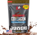 PhysiVantage Supercharged Collagen Peptides Powder - Hydrolyzed Collagen for Joint, Tendon, Ligament, & Skin Health Support - Chocolate, Keto, Paleo, 16oz | Enhanced with Vitamin C, BCAAs, Grass-Fed