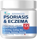Crème Bio-MD Psoriasis Eczema, Crème Eczema pour les adultes, Réoccurrence de contrôle supplémentaire de la force, Symptôme de soulagement de la résistance, efficace pour la dermatite séborrhéique, traitement de la folliculite