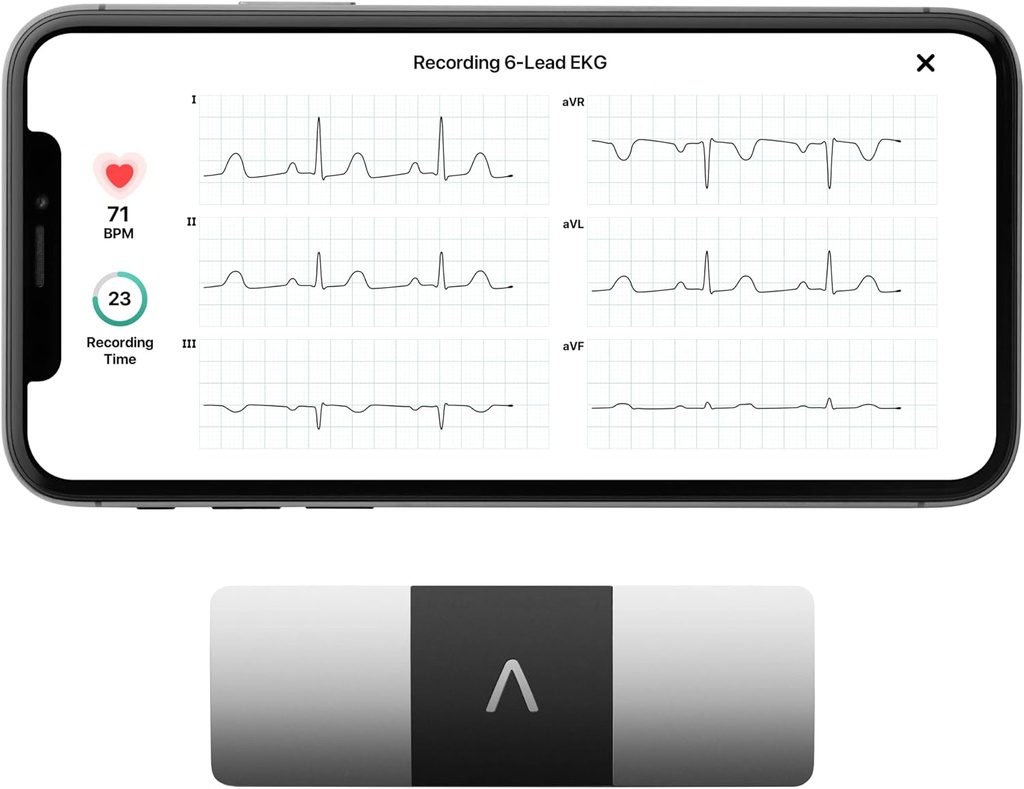 AliveCor KardiaMoniteur EKG personnel 6-Lead – Six Vues du Coeur – Détecte AFib et les arythmies irrégulières – Résultats instantanés en 30 secondes – Fonctionne avec la plupart des smartphones