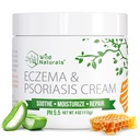 Crème d'eczéma et de psoriasis pour peau sèche et démangeeuse – Eczema Relief pour adultes et enfants – Crème de psoriasis hydratante au miel Manuka