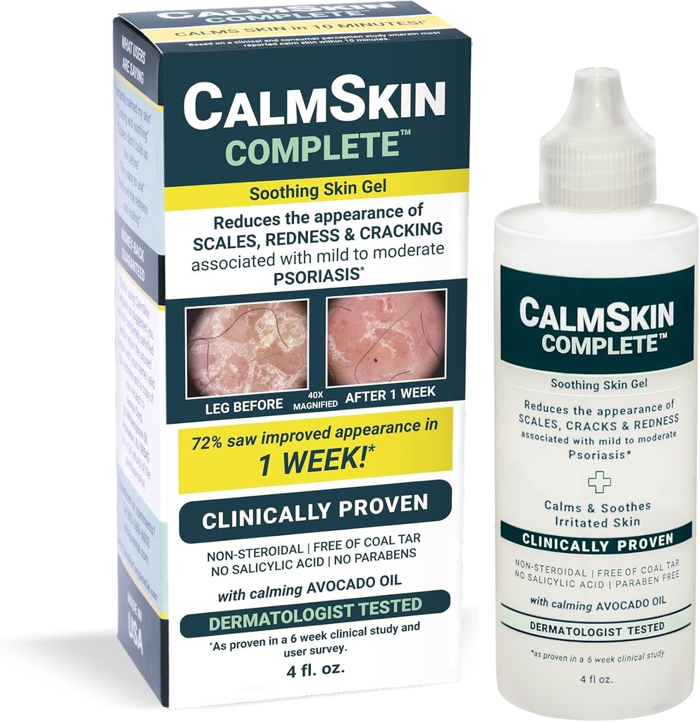 Xenna CalmSkin Complete (Clinically Provened to Soothe Irritated Skin and Improve The Apparence of Skin with Mild to Modéré Psoriasis) Fabriqué aux États-Unis