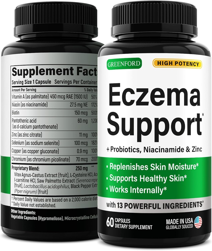 Greenford Eczema Traitement et soutien pour le soulagement naturel - Fabriqué aux États-Unis - Vitamines et plantes cutanées pour l'eczéma, l'acné, le psoriasis, le traitement Rosacea avec le zinc, le niacinamide et les probiotiques - 60 capsules