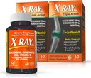 X Ray Dol Triple Action Joint Support Supplement with Glucosamine 1500mg, Chondroitin 800mg, MSM 750mg and 5X Vitamin D for Healthy Joints, Bones & Cartilage - 60 Count per Bottle - 2 Pack