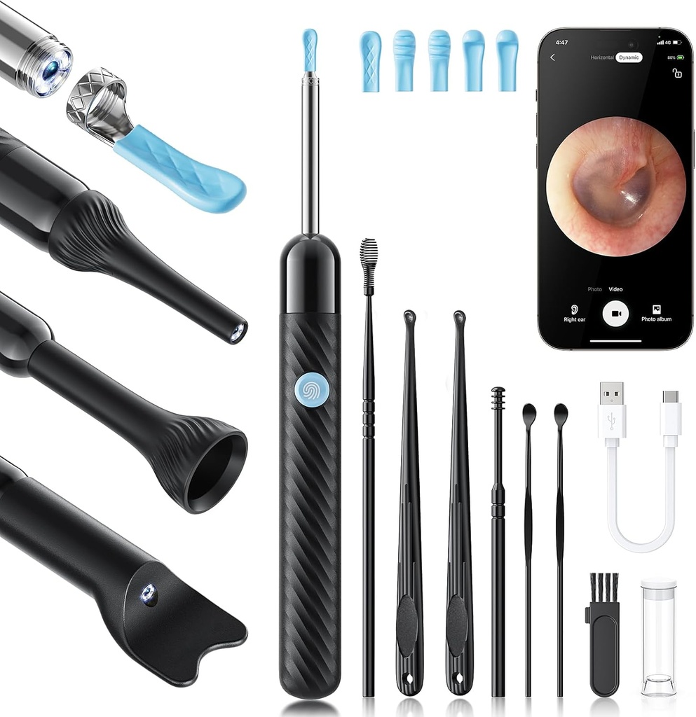 Loyker X6 Ear Wax Removal Tool Camera, Nettoyeur d'oreille avec caméra, FSA - HSA Store Admissible, 1080P Caméra d'oreille avec lumière 6LED pour l'examen de l'oreille/du nez/de la gorge/de la pierre de tonsil, noir